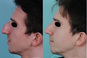 LA CHIRURGIE ESTHETIQUE CE QU'IL FAUT SAVOIR